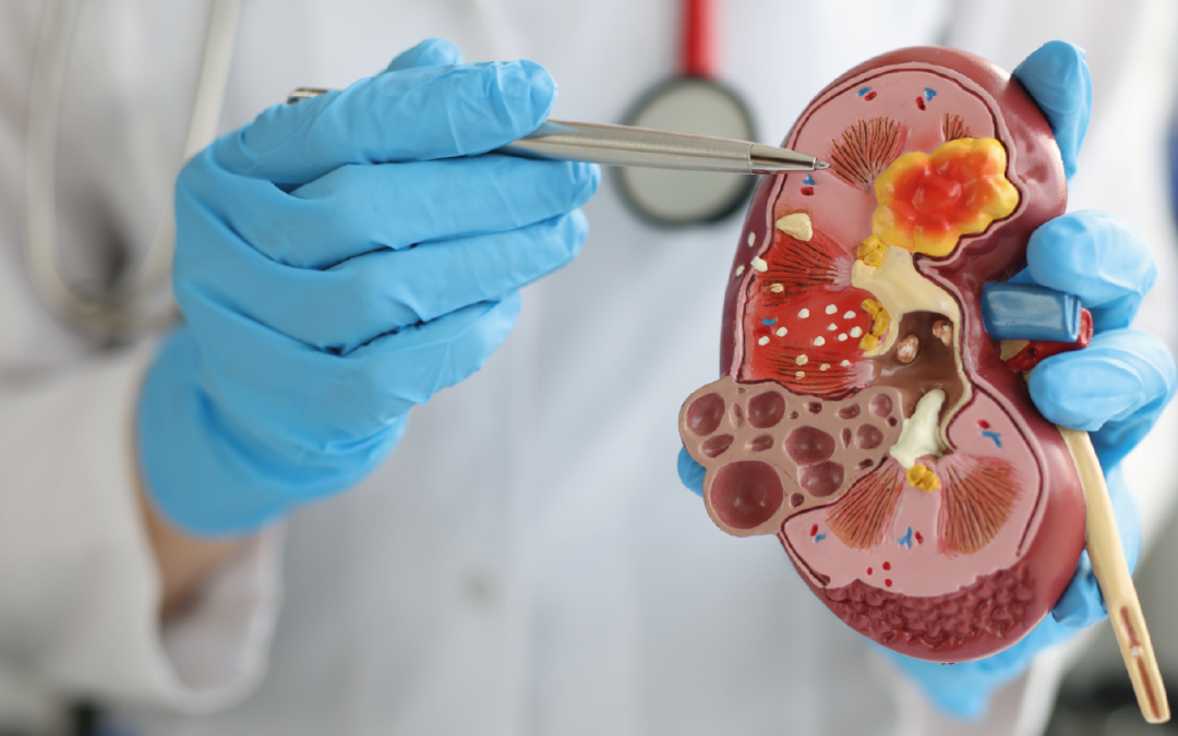 Descarte de enfermedades de próstata