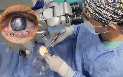 Cataratas: señales de alerta y cuándo la cirugía se vuelve necesaria