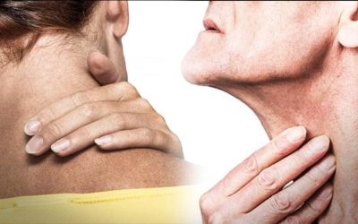 Cáncer de cabeza y cuello causa más de 450 mil muertes al año